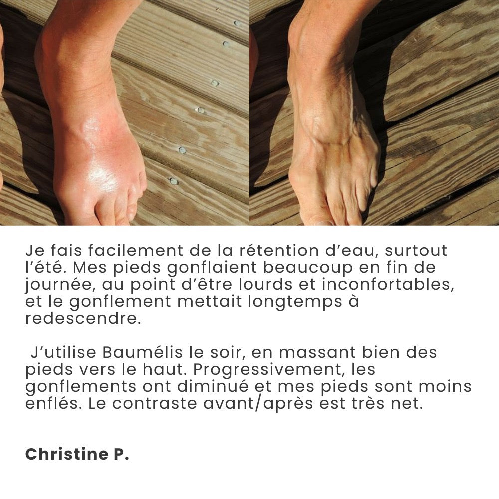 Témoignage cliente Christine P. — photos comparatives du pied, sensation de confort et de légèreté.
