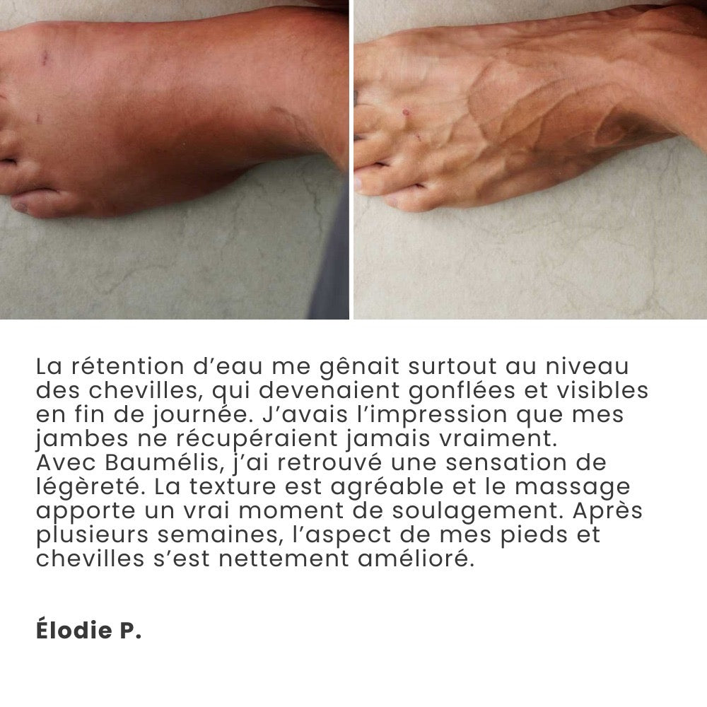 Témoignage cliente Élodie P. — photos comparatives du pied et de la cheville, sensation de légèreté au quotidien.