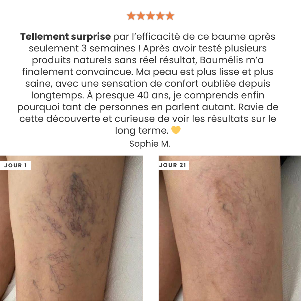 Photos comparatives jambes — résultat visuel sur 3 semaines.